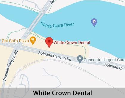 Map image for Dental Bridges in Santa Clarita, CA